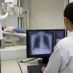 curso técnico gratuito IFPR FORMATEC-SUS Enfermagem Radiologia